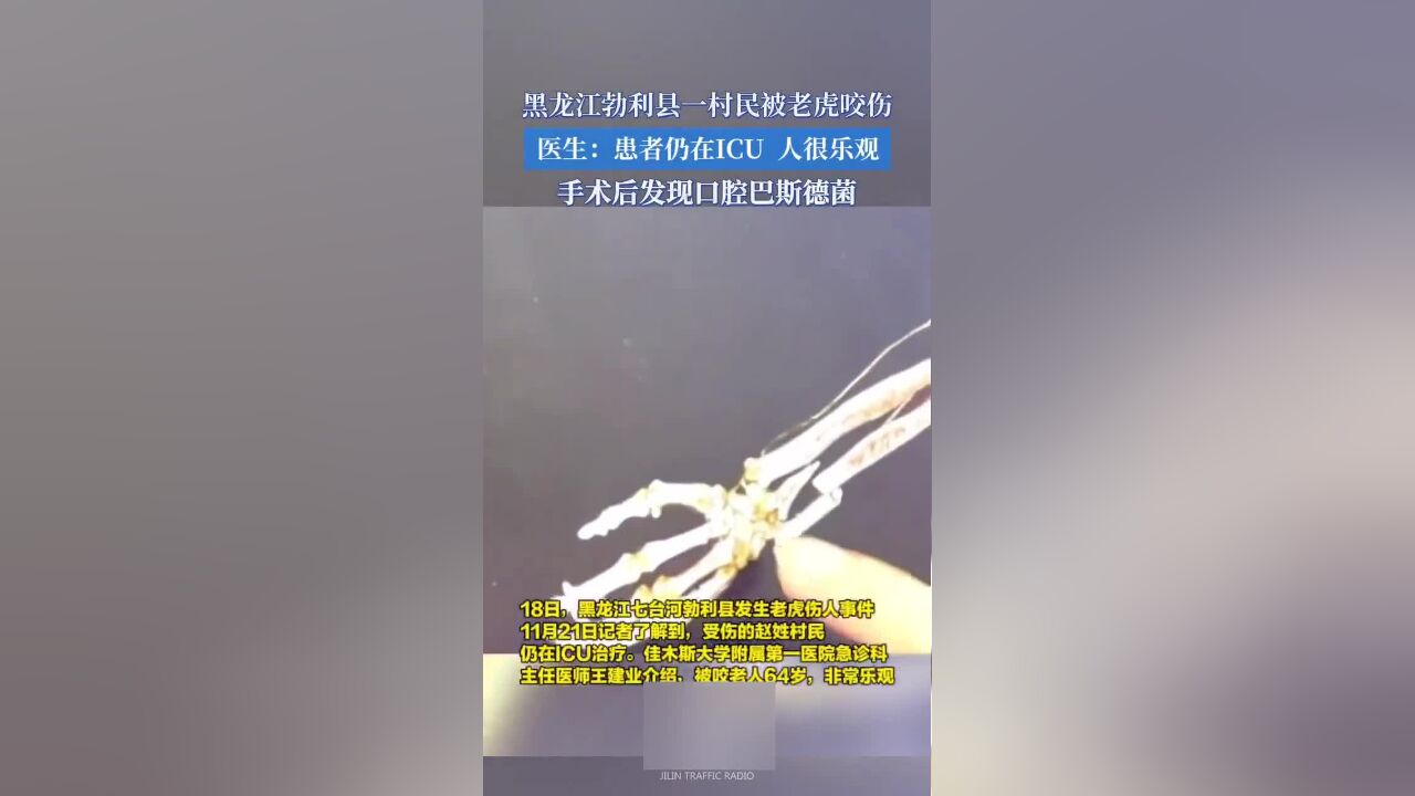 黑龙江勃利县一村民被老虎咬伤,医生:患者仍在icu,人很乐观.