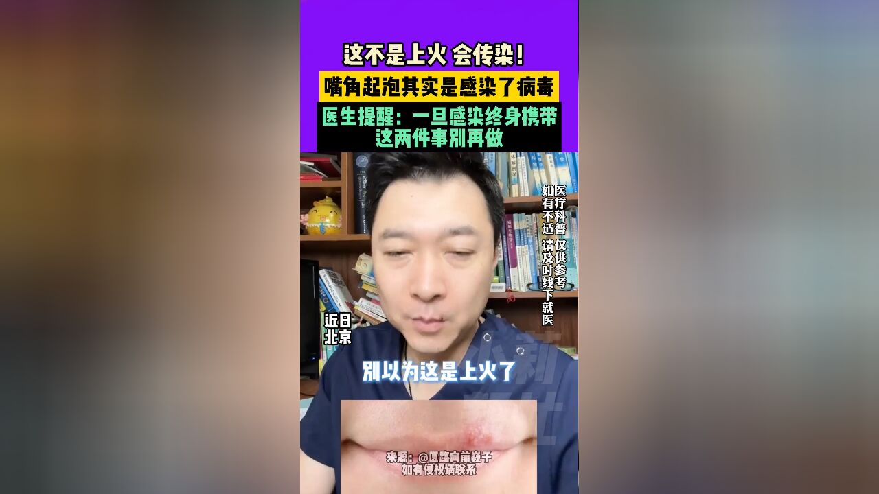 近日,北京,这不是上火,会传染!嘴角起泡其实是感染了病毒,医生提醒:一旦感染终身携带,这两件事别再做