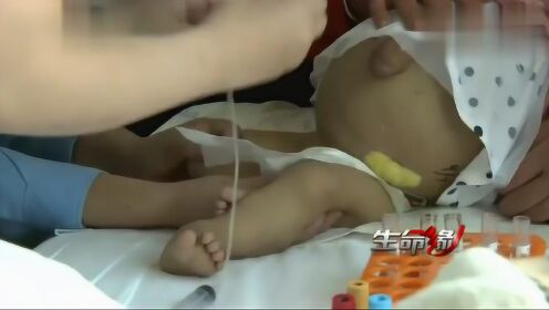 女婴随时陷入肝昏迷,最有效办法就是白醋灌肠,她能承受住吗?