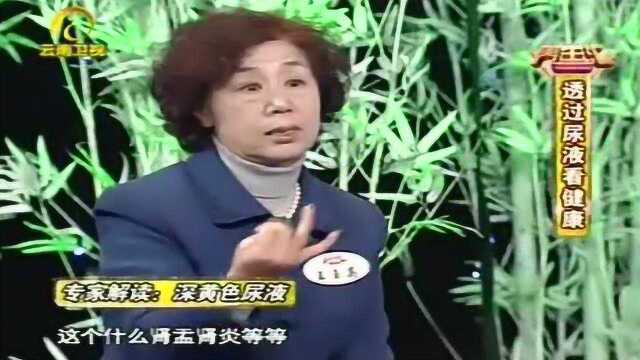 尿液持续深黄需谨慎,医院化验要不了多少钱,早期发现病症