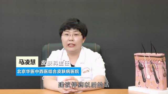 光子嫩肤治疗前需要做什么准备?皮肤科主任马凌慧