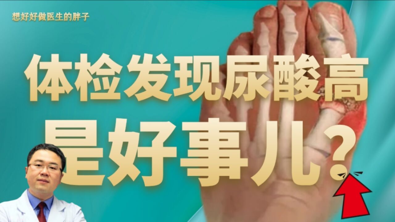 体检发现尿酸高,是好事儿?医生详解原委以及何时应药物降尿酸!