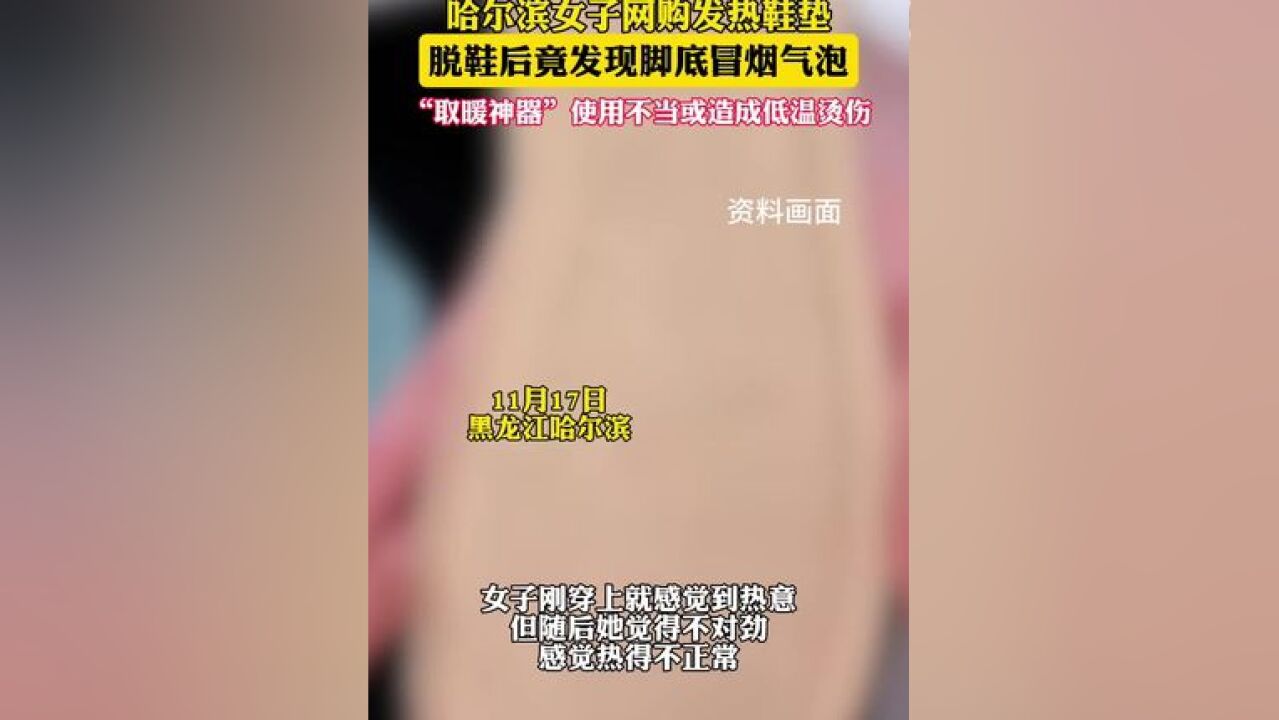 哈尔滨女子网购发热鞋垫,脱鞋后竟发现脚底冒烟气泡