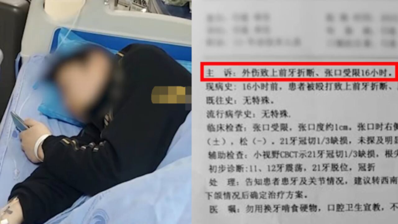 女牙医称提离职未获准,遭老板威胁殴打致牙齿断裂,警方介入