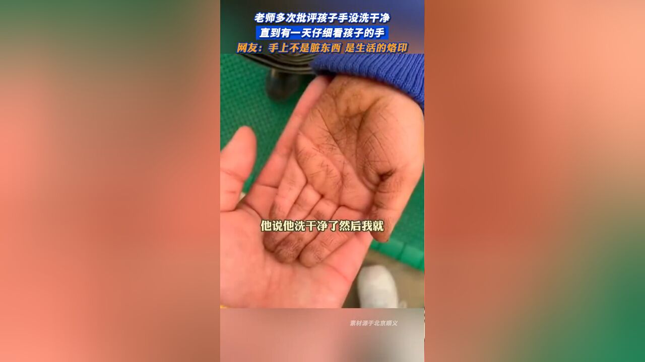 老师多次批评孩子手没洗干净 直到有一天仔细看孩子的手