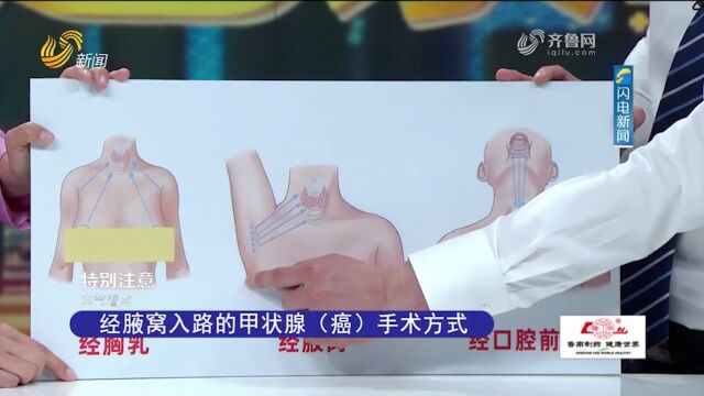 专家详细介绍经腋窝入路腔镜下手术,来看其适用情况