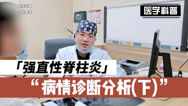 强直性脊柱炎相关病情诊断分析,看看肖医生如何诊断(下)