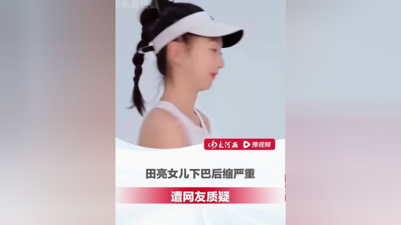 网友称田亮女儿下巴后缩严重 ,或已错过最佳矫正时期,田亮 :矫正正在进行中,需要时间,这种营销号就随便看看吧