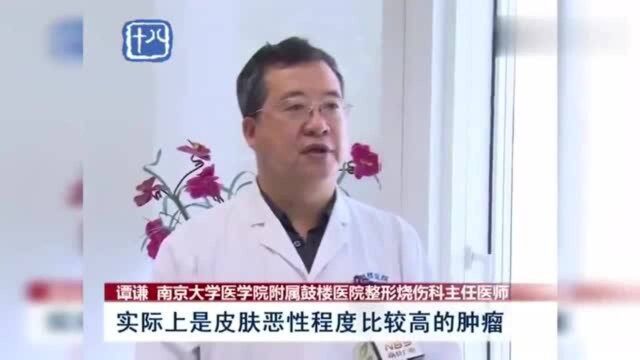 南京:爱美的看过来!有痣就要切除?正规医院就诊很必要