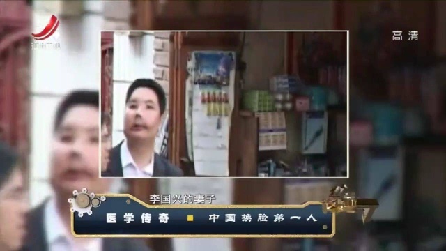 经典:换脸第一人李国兴,成功后离奇自杀,他的死与手术有关?