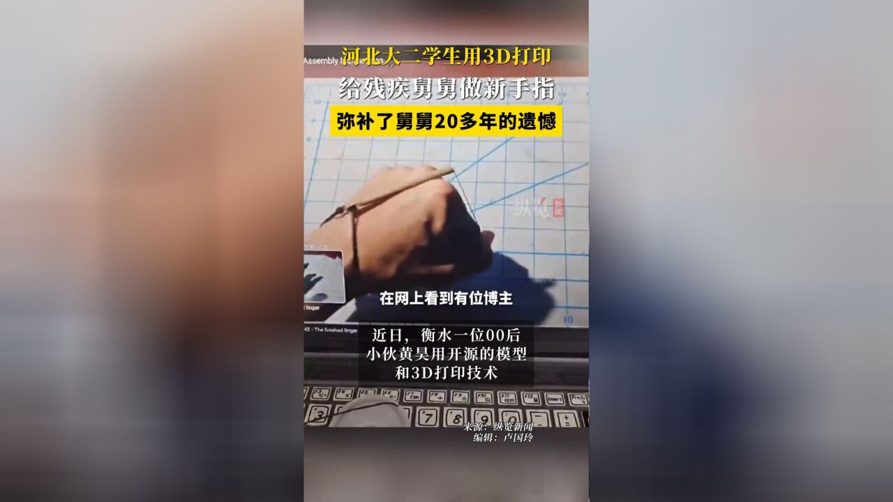 河北大二学生用3D打印给残疾舅舅做新手指