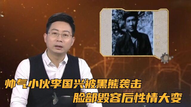 帅气小伙李国兴被黑熊袭击,脸部毁容后性情大变