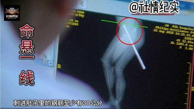 一米长钢筋从后面刺进,男子命悬一线,二十个医生救援,纪录片