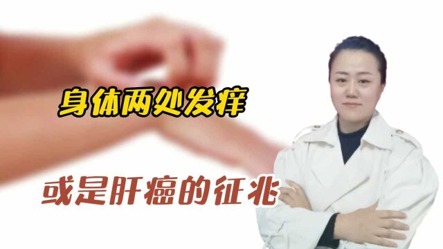 身体两处“发痒”,别误以为是过敏了,或是肝癌的征兆,需警惕