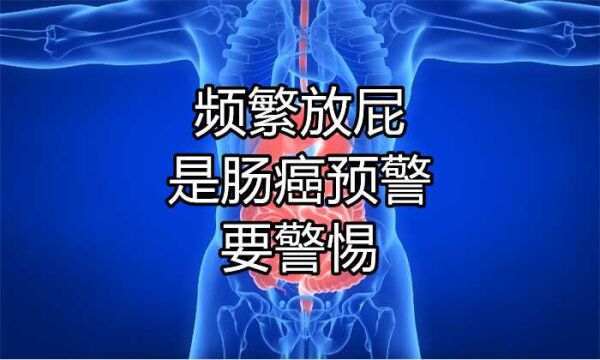 “频繁放屁”是肠癌预警吗?肿瘤科医生:出现4种症状,应尽早检查