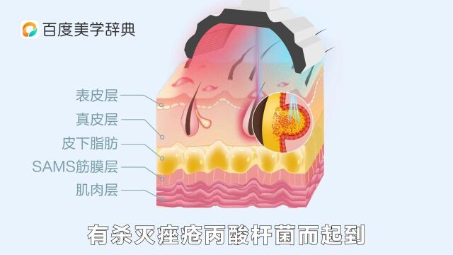 美丽大健康联盟:什么是红蓝光祛痘