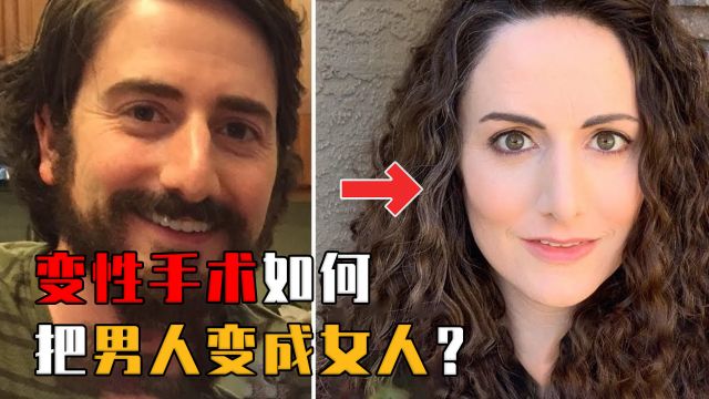 揭秘变性手术全过程:男人是如何变成女人的?变性人到底有多难?