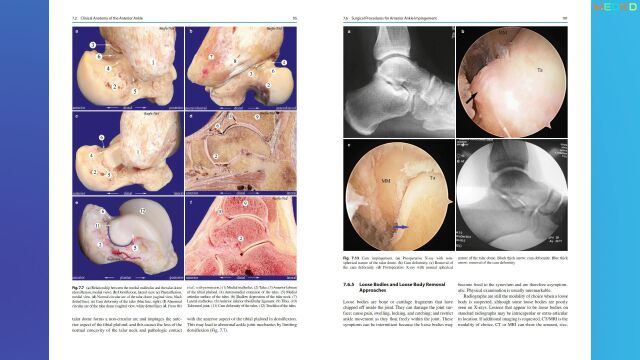 书简:关节镜技术与足部和踝关节解剖 外科图谱Arthroscopic Techniques and Anatomy of the Foot and Ankle