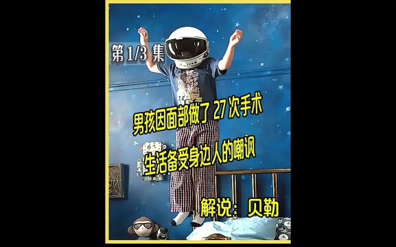 奇迹男孩:男孩因面部做了27次手术,生活备受身边人的嘲讽#电影解说 #贝勒电影 #奇迹男孩