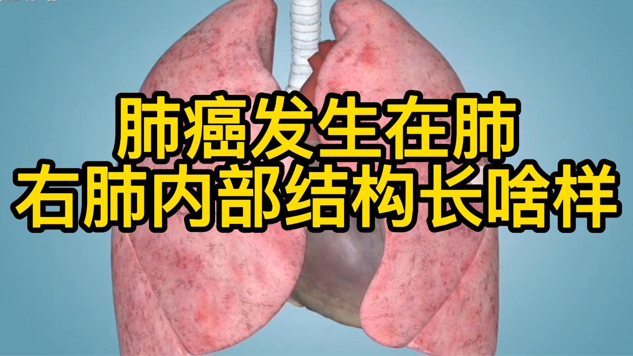 肺癌、肺结节发生在肺,右肺内部结构长啥样?外科医生通过3D解剖讲解