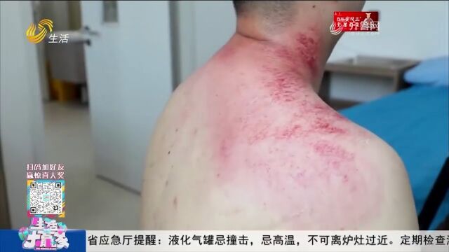 夏季养生正当时!听专家教你如何正确刮痧