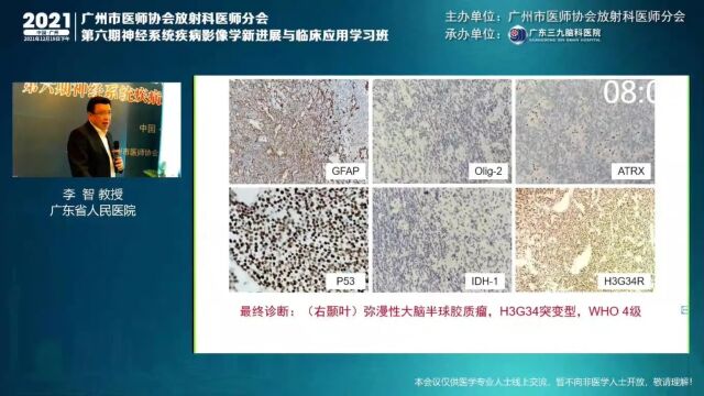 WHO CNS5胶质瘤分类诊断新进展广东省人民医院李智