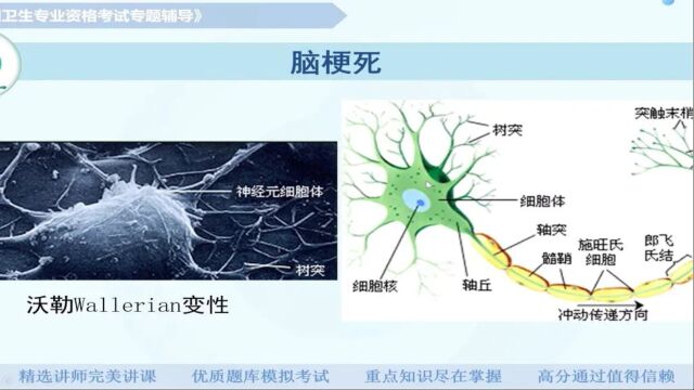 【放射医学(中级)】第八章神经系统及头颈部:脑梗死