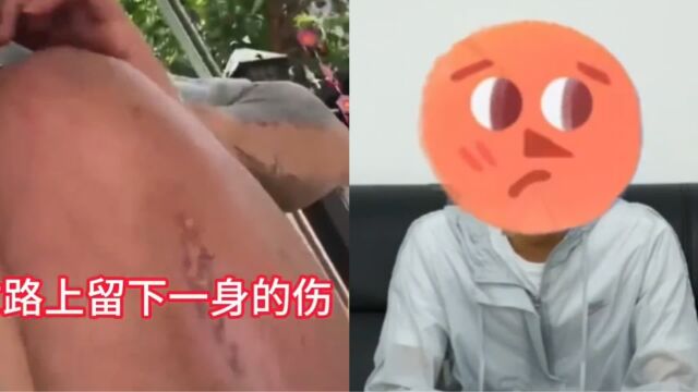 男子不会英语被转卖10多家诈骗公司,赤脚翻山从枪口下逃离缅甸