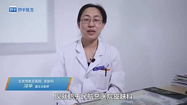 北京航空总医院,皮肤科副主任医师冯华:斑秃怎么办?