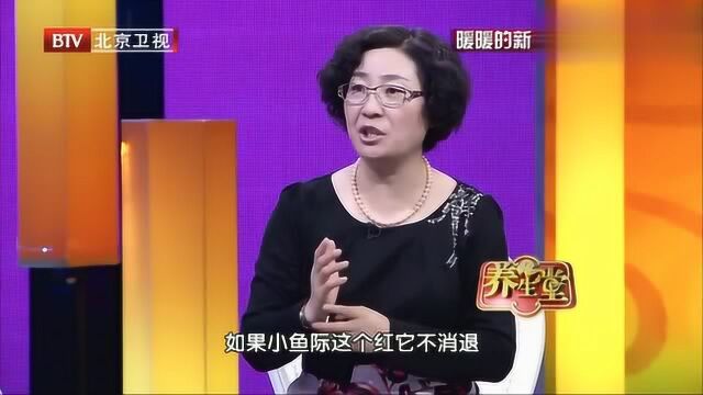 养生堂:手掌红代表什么呢?听听专家怎么说!