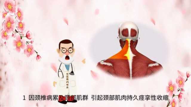 颈椎病为什么会引起头痛?医生直言:有4个原因,很多人不清楚