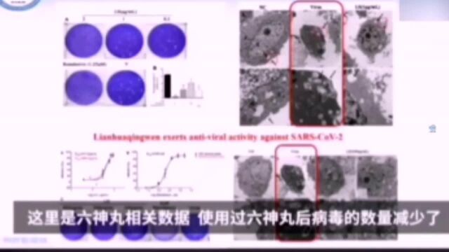 钟南山向欧洲推荐中药“六神丸”