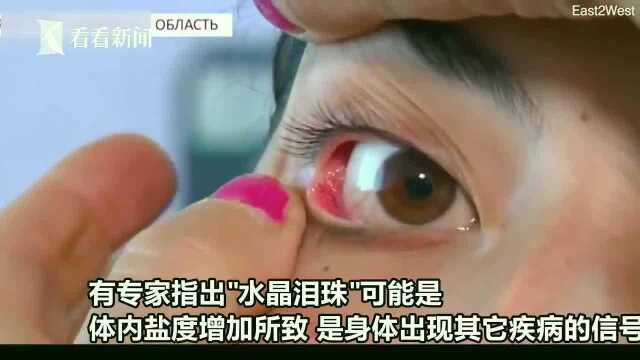 女子每天哭50粒水晶泪珠,起初以为玻璃渣迷眼