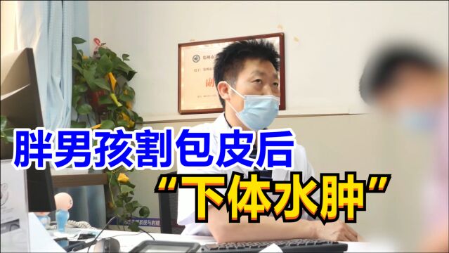 胖男孩割包皮后“下体水肿”,奶奶吓坏乱求医,专家1招搞定!