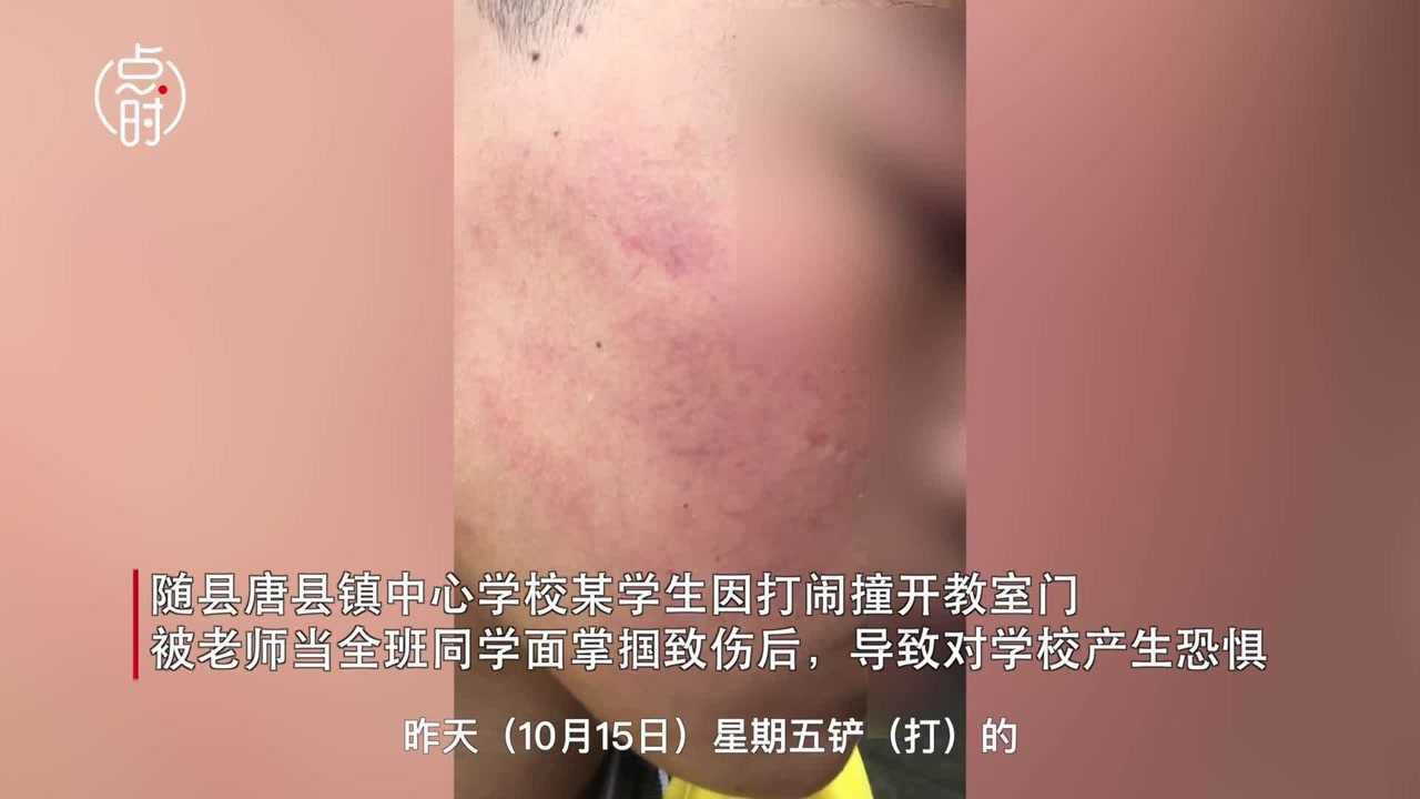 湖北学生遭老师当全班面掌掴,教育局:涉事教师停课并处分