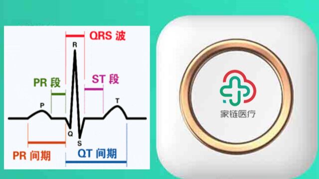 阳康后家用心电图仪监测心脏健康很重要