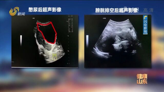 超声检查的临床应用范围包括哪些?医生一一列数