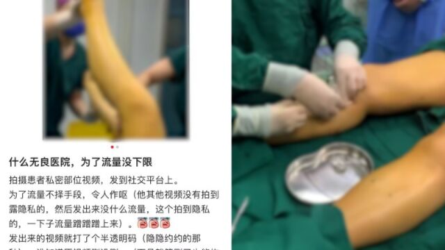 河北一医生发布患者手术视频被指侵犯隐私,院方:做医学科普,已经过患者同意