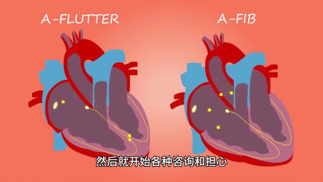 肿瘤标志物CA199的背后故事:不只是癌症的警示信号