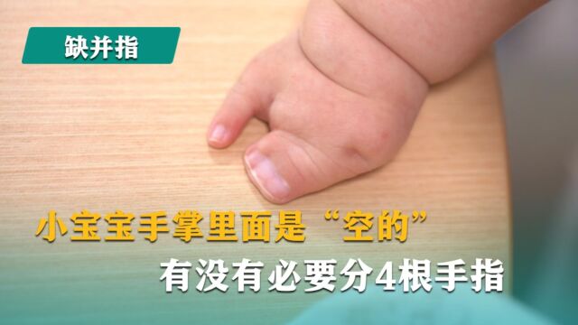 小宝宝手掌里面是“空的”,有没有必要分4根手指