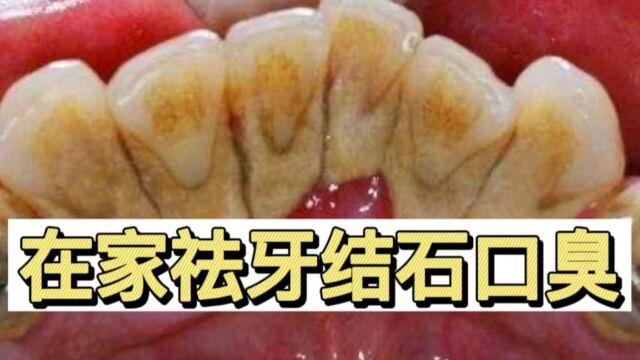 抽烟牙黄还臭味熏天?闲时在家这样做!不用洗牙就能清除口臭!