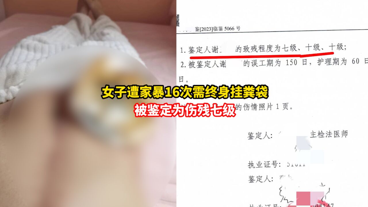 遭家暴16次女子鉴定为伤残七级,需终身戴着粪袋生活,目前仍未离婚成功