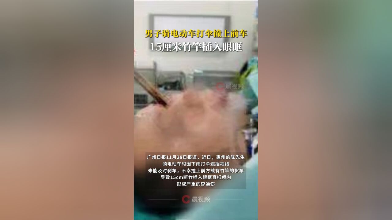 危险!男子骑电动车打伞撞上前车,15厘米竹竿插入眼眶