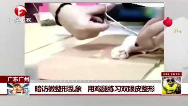 暗访:广州白云区微整形乱象 用鸡腿练习双眼皮整形腾讯视频