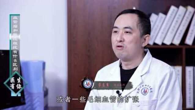 医生有你:血管瘤和鲜红斑痣有什么区别?