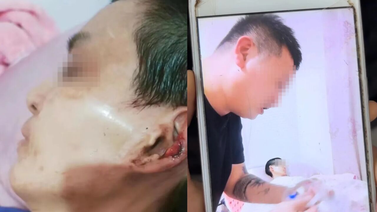 渐冻症妻子疑遭网红丈夫虐待,生前多次被掌掴辱骂:干嘛不死快点