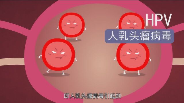 3分钟了解HPV疫苗