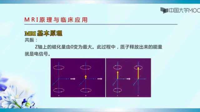 【医学影像学】磁共振成像(MRI)的基本原理和应用