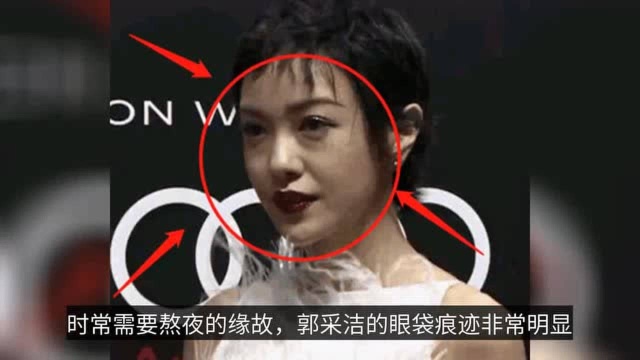 郭采洁无精修生图变化大,昔日比肩杨幂,这是女明星真实状态吗?