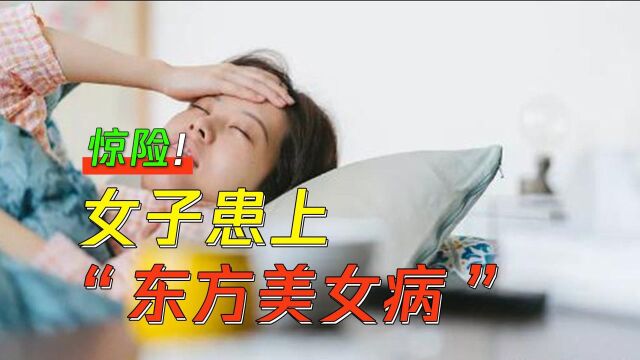 34岁女子感觉不到脉搏跳动,竟是患有“东方美女病”!